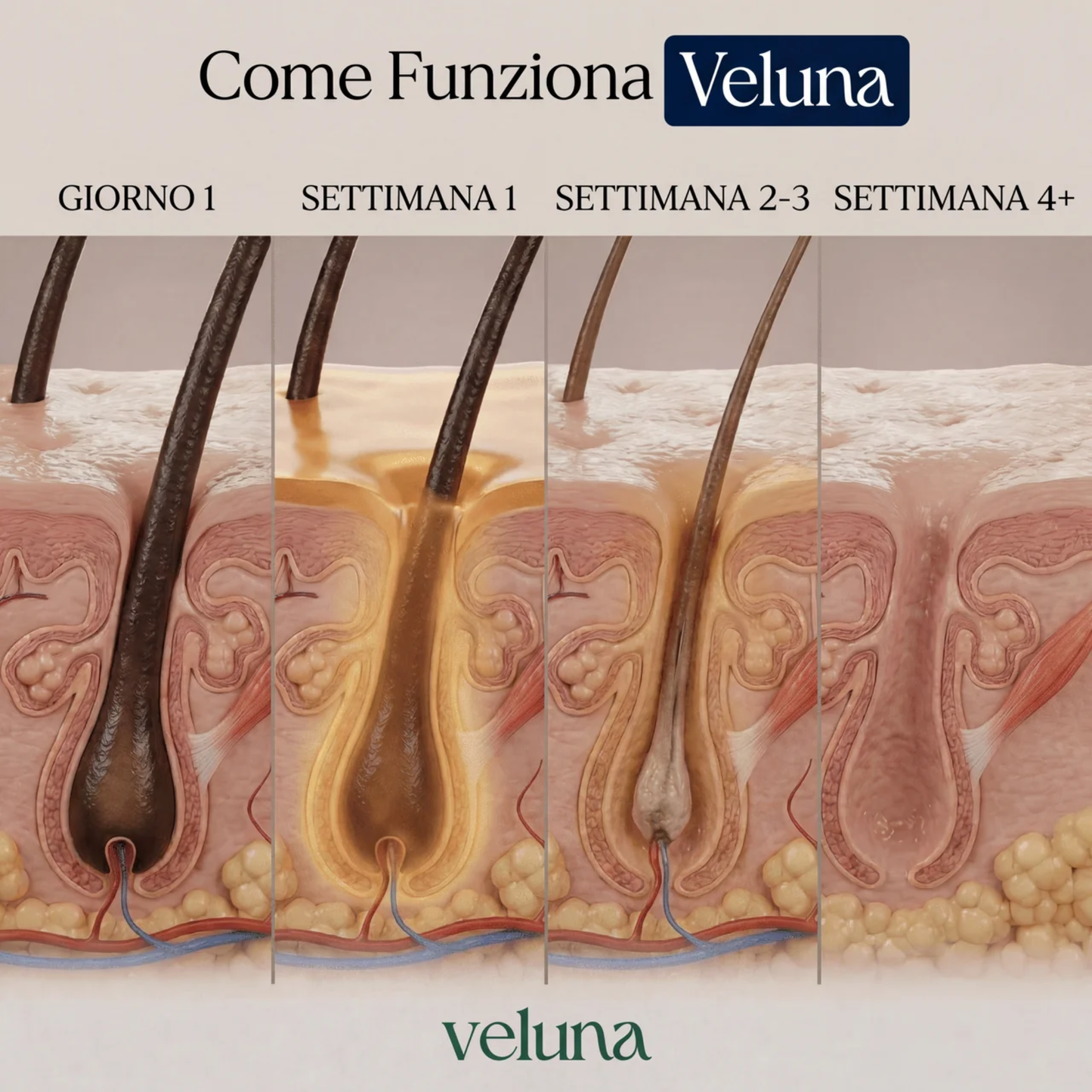 Veluna™ Siero alla Cyperus Rotundus | Ferma naturalmente la crescita dei peli indesiderati